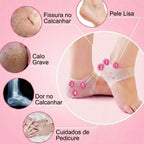 Protetor de Calcanhar Silicone Gel: Acabe com as Dores e o Cansaço